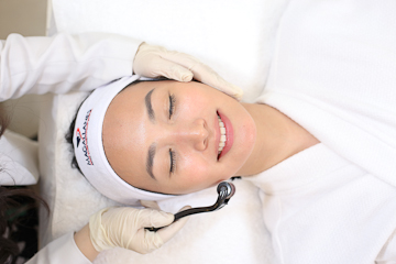 Microneedling